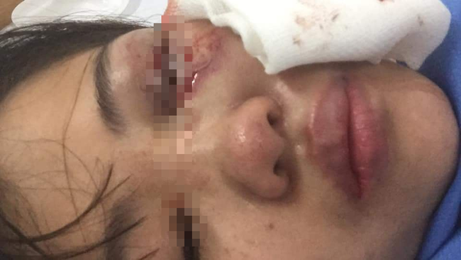 Hà Nội: Nữ nhân viên điều hành của một hãng taxi tố bị chồng hành hung, đánh đập dã man - Ảnh 2.
