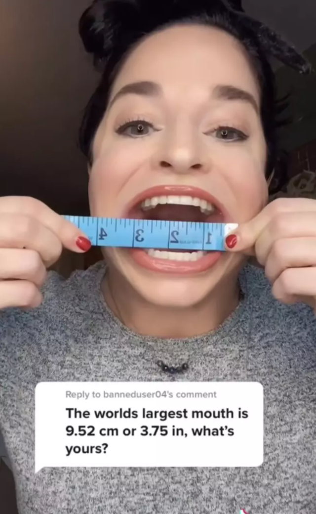 Được hàng trăm ngàn người hâm mộ nhờ “chiếc miệng rộng nhất thế giới” - 2